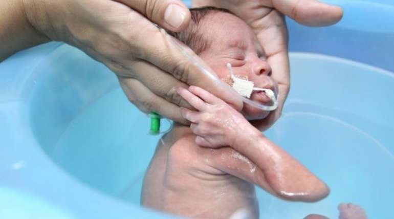 Fisioterapia acuática neonatal…